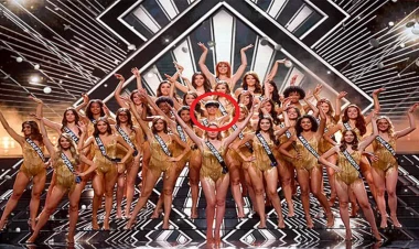 Fransada daha bir biabırçılıq - 