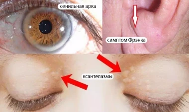 Üzündə, gözündəki dəyişikliklər ürəyindən xəbər verir