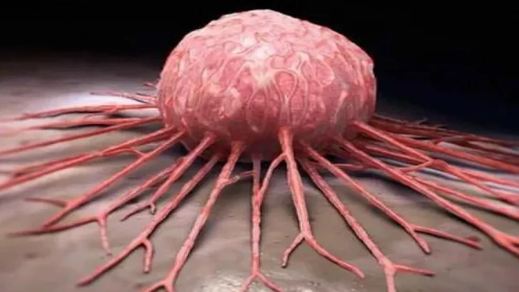 Xalq artisti xərçəngə qalib gəldi