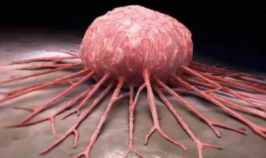 Xalq artisti xərçəngə qalib gəldi