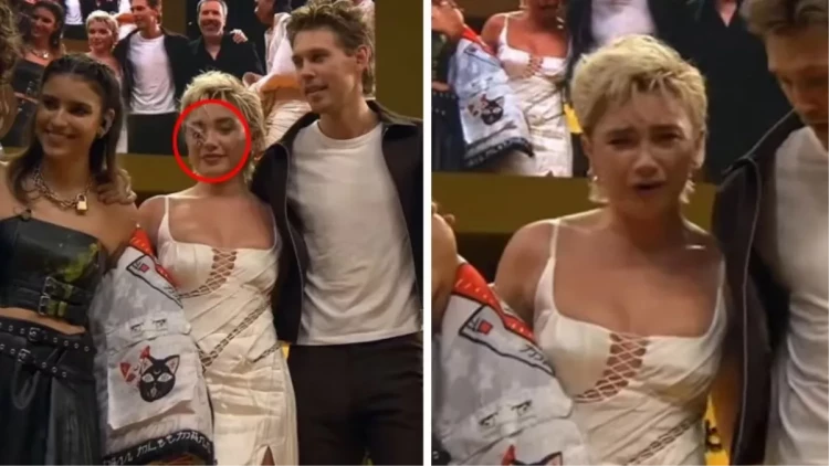 Aktrisanın səhnədə başına iş gəldi - FOTOlar