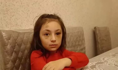 “Direktor maddiyyatla həll etmək istəyirdi” – Döyüldüyü deyilən məktəblinin ANASI – VİDEO