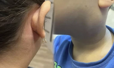 “Svinka”ya yoluxma halları da artıb?