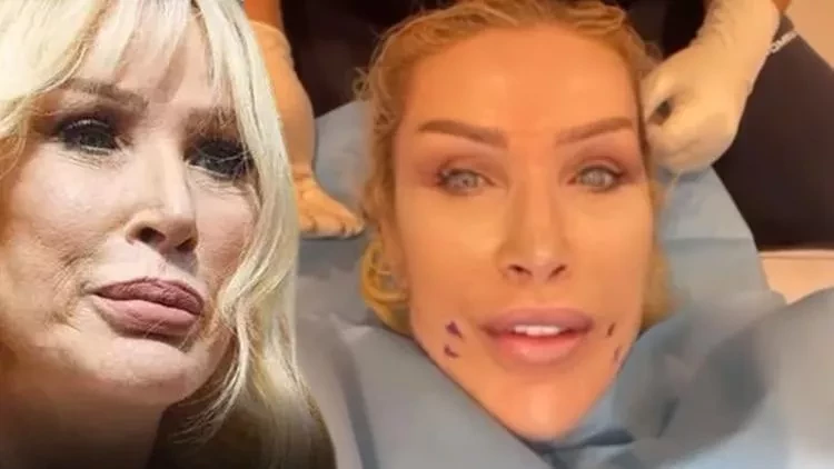 Məşhur müğənnidən gəncləşmək üçün ağlasığmaz addım: Kişinin dərisindən... - FOTO