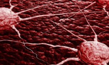 Gizli düşmən - Xərçəng yaradan əsas səbəb