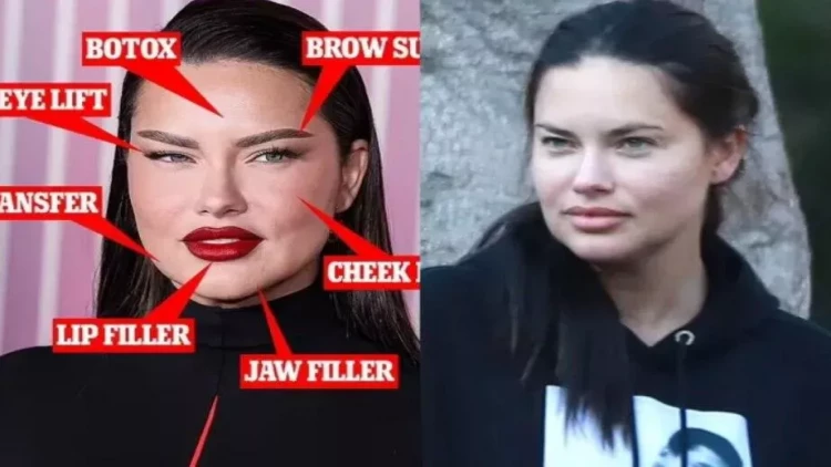 Paparasilər Limanın yalanını üzə çıxardılar - FOTO