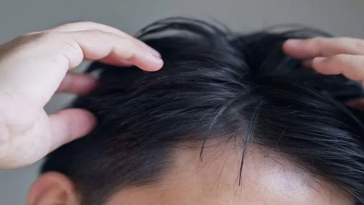 Gəncin başından qopardığı qəribə “buynuz” görənləri çaş-baş qoydu - FOTO