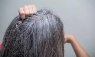 Ağarmış saçlara son – bu üsullarla