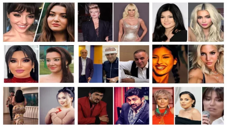 Plastik əməliyyatlardan sonra başqa birinə çevrilən ulduzlar - SİYAHI