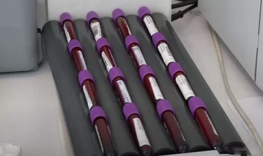 Onkoloji xəstəliklərin tibbi sığorta ilə müalicəsində YENİLİK - VİDEO