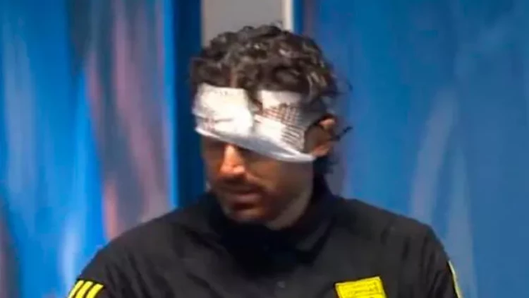 “Marsel” – “Lion” matçı ləğv edildi