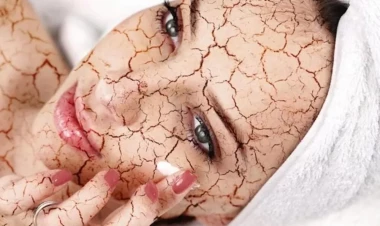 Stress sizdə bu problemləri yaradacaq