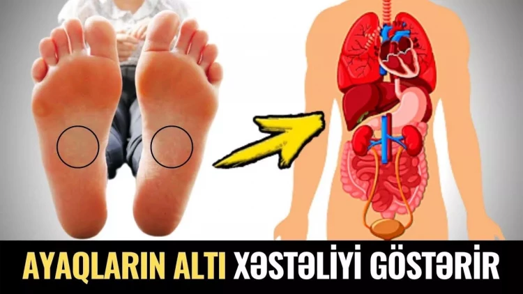 Ayaqların Altına Baxın! - 10 Saniyədə xəstəliyiniz bilinəcək