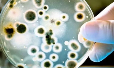 Bədənimizdəki bu nahiyələr mikrobla dolu imiş - Diqqət!