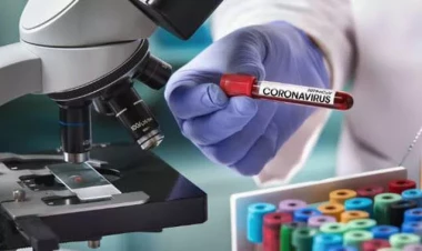 COVID-19-a yoluxanların sayı artdı