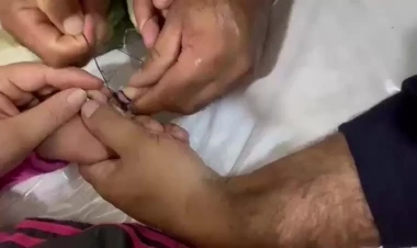 Bərdədə uşağın barmağına halqa ilişdi, köməyə FHN gəldi - VİDEO