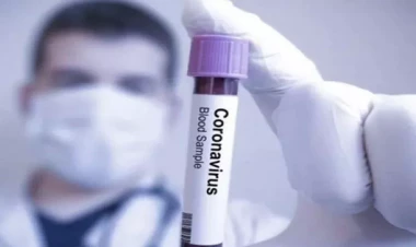 Azərbaycanda koronavirusun yeni variantı aşkarlanıb? - Rəsmi açıqlama