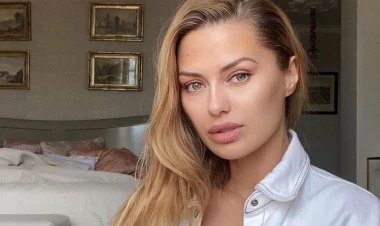 Plastik əməliyyat onu tanınmaz hala saldı - FOTO