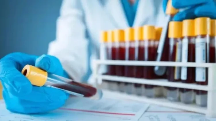 Yemək zamanı ortaya çıxan XƏRÇƏNG ƏLAMƏTİ