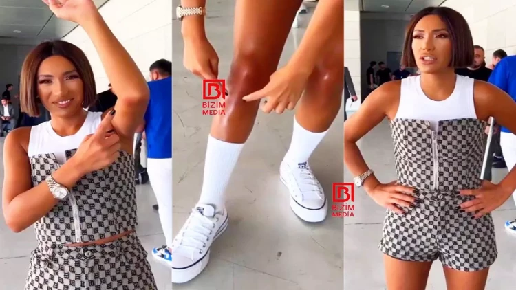 Üç gün konsert verən Röya səhnədə aldığı bədən xəsarətlərini GÖSTƏRDİ – VİDEO