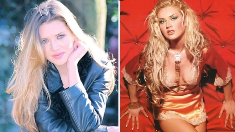 Bir vaxtlar qulaqlarını yapışdıran modelin indiki halı təəccübləndirir - FOTO