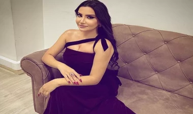 Əməkdar artist plastik əməliyyatdan sonra belə oldu - FOTO