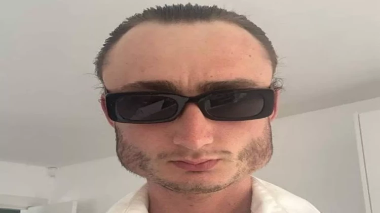 Boksdan üzü bu hala düşdü - FOTO