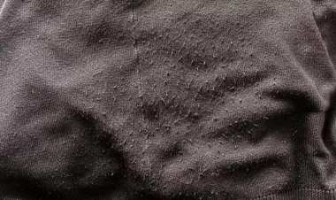 Tiftikləri asanlıqla təmizləyən üsul - yeni kimi görünəcək