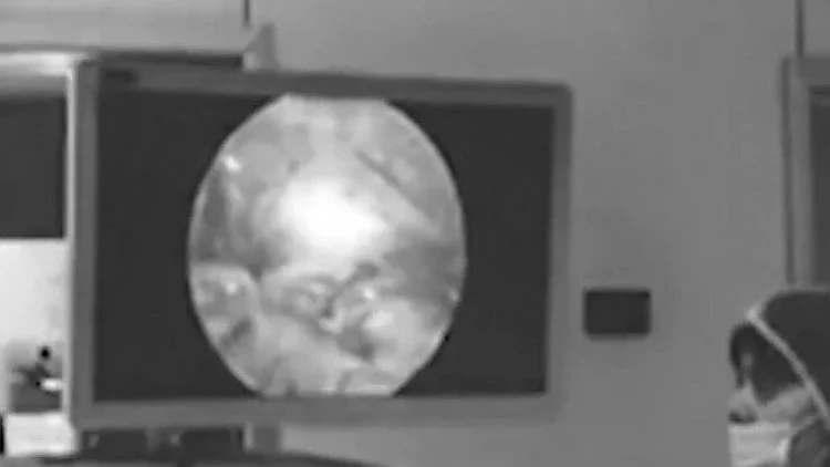 Azərbaycanda ŞOK OLAY - 13 yaşlı qız əməliyyatla oğlan oldu