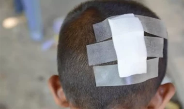 Hesaba görə kafe sahibi ilə mübahisə etdi, 6 yaşlı oğlu başından zərbə aldı