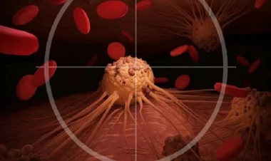 Xərçəngdən qoruyur, ürək-damar xəstəlikləri riskini azaldır - Alaq otunun SİRRİ AÇILDI