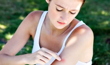 Hansı rəng geyim ağcaqanadları cəlb edir?