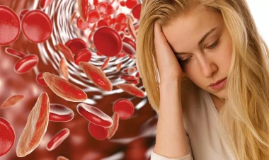 Anemiya yarada biləcək xəstəlik açıqlanıb