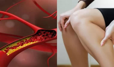 Qan laxtalanması problemi genetik imiş