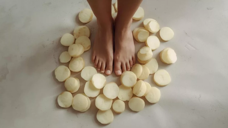 Kartof dilimini ayağın altına qoymaq soyuqdəyməni müalicə edir? - Mütəxəssisdən açıqlama