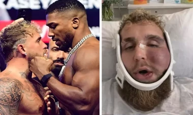 Çənəsi sındı, amma 92 milyon dollar qazandı - FOTO