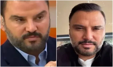 Alişan botoks etdirdiyini belə etiraf etdi - FOTO