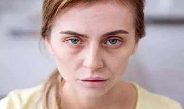 Üzün solğun olması hər zaman qanazlığı demək deyil - Həkim