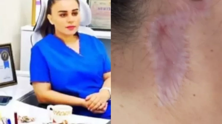 “Məni gözəllik salonunda əməliyyat etdi, ağzım əyilir” - VİDEO