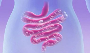 Köpdən əziyyət çəkənlər bu qidaları yeməsin - SİYAHI