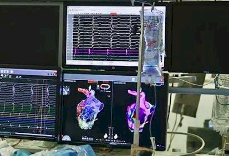 Ürəyin “kiçik beyni”nin 3D xəritəsi hazırlandı